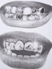 BOUNCE BACK | T-Shirt Streetwear con Grafica Labbra Scure e Denti Grillz