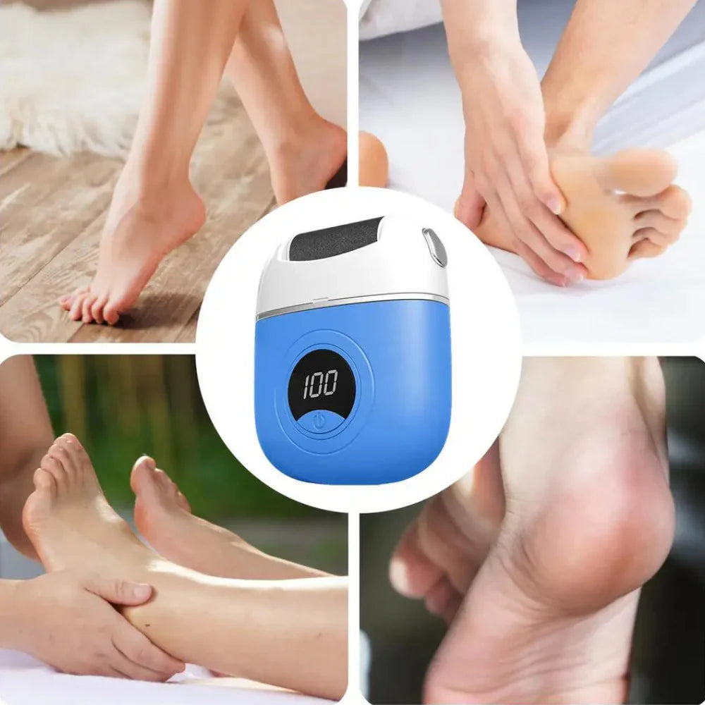 <tc>Electric Callus Remover™ | Soft &amp; Beautiful Feet</tc>